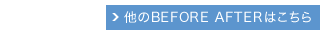 他のBefore Afterはこちら